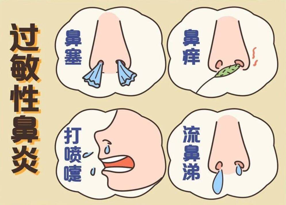 鼻炎喷药无效?重庆仁品医院提醒：先分清这5种类型，否则可能越治越堵