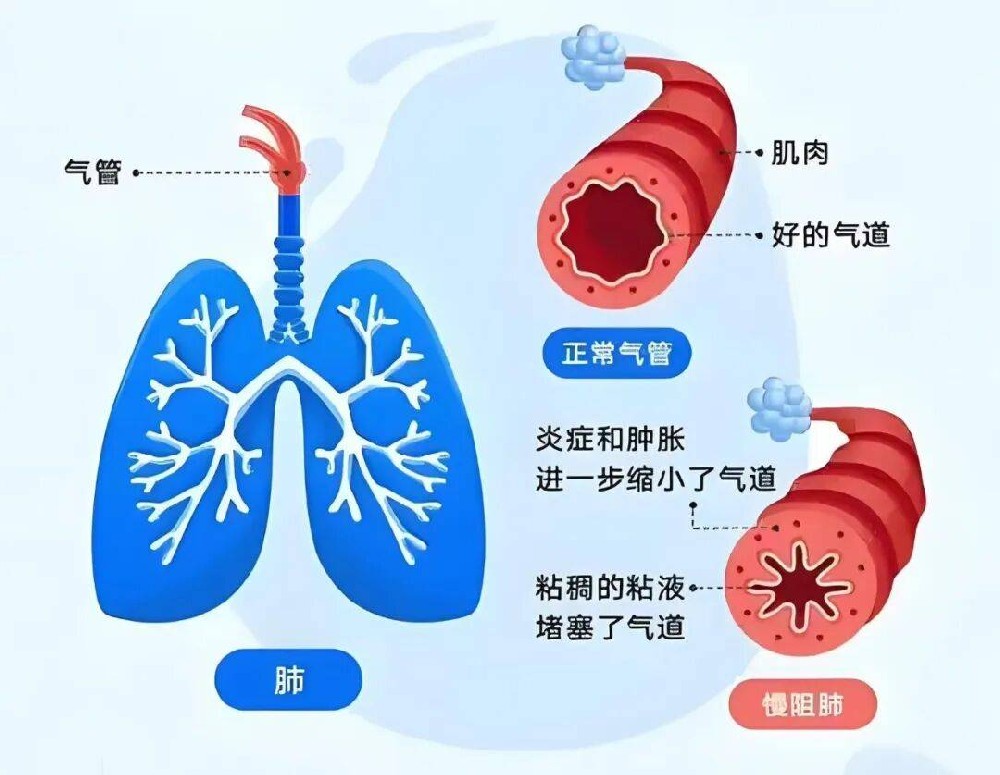 1亿国人正被这种“会呼吸的痛”折磨!重庆仁品医院康复医学科：出现这些信号，千万别再硬扛