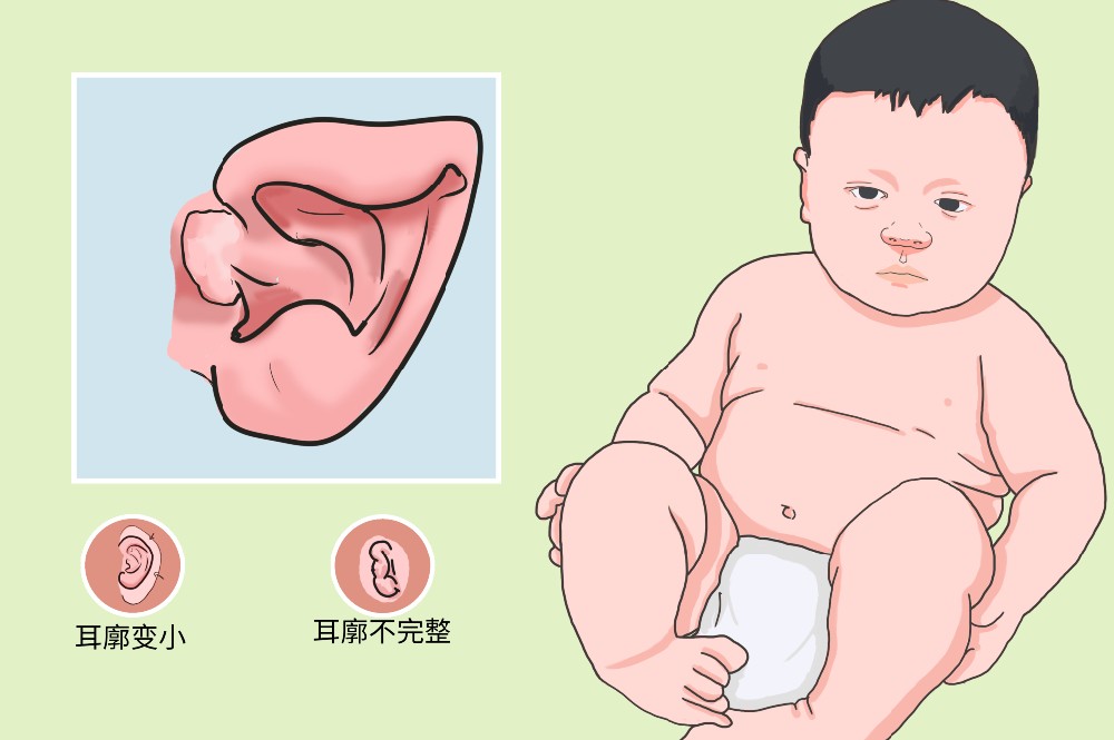 重庆仁品医院专家联手完成耳再造+听力重建：一次手术同期解决外观与听力难题