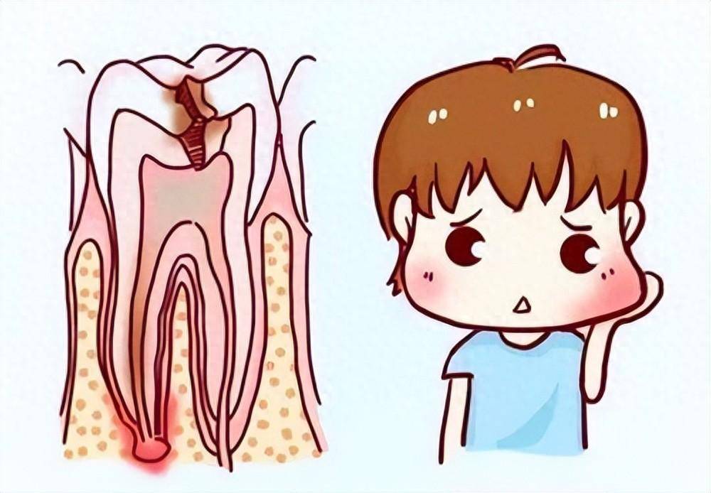 乳牙根管治疗：别等恒牙长歪了才后悔!重庆仁品医院提醒家长重视