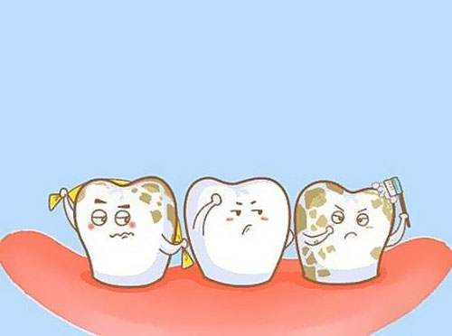 牙齿着色、牙黄如何改善?重庆仁品医院口腔科科普牙齿美白